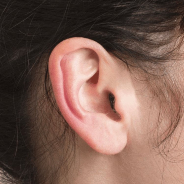 An invisible-in-canal hearing aid, fitted deep enough in the canal to stay out of sight