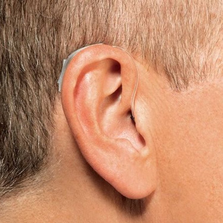 A receiver-in-canal hearing aid: a slim case worn behind the ear with a thin wire running into the ear canal